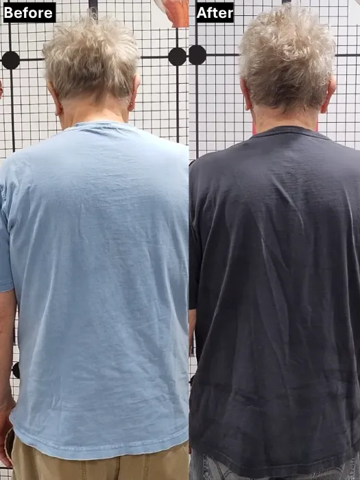 Posture before and after