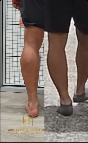Muscle tension before and after
